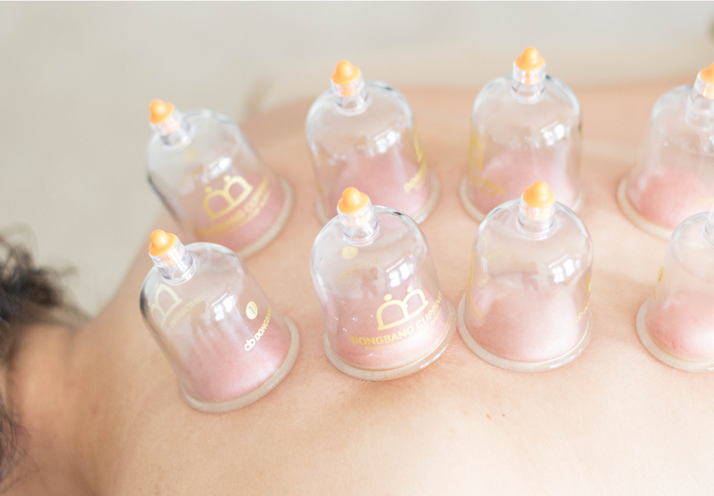 Ya'Care propose les massages aux ventouses