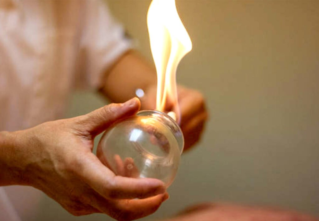 Ya'Care propose le massage aux ventouses chaudes